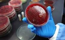 Blood culture tests