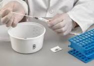 Fecal sample culture tests