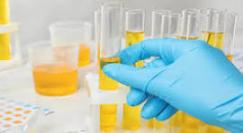 Urine culture tests